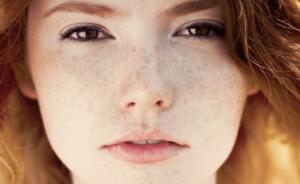 Five Ways to Make Face Free from Freckles