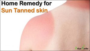 Amazing Home Remedy for Sun Tanned skin during summers