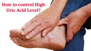 How to control High Uric Acid Level?