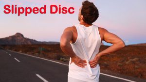 It’s better to know the Slipped Disc problem first before any medication