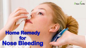 Nose Bleeding : Easy home treatment