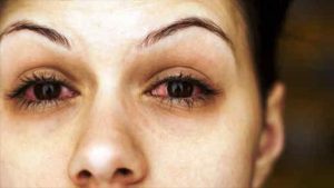 This Herb prevent you from seasonal Eye problems for whole one year
