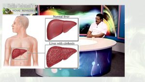 Your Liver is very important & precious, take care of it