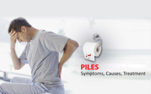 Don’t Let Piles Make Your Day Painful and Itchy