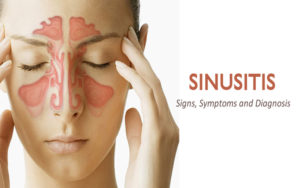 How to Keep Sinusitis At Bay With Natural Means