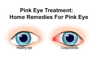 Blink Well by Healing Pink Eye with a Natural Treatment